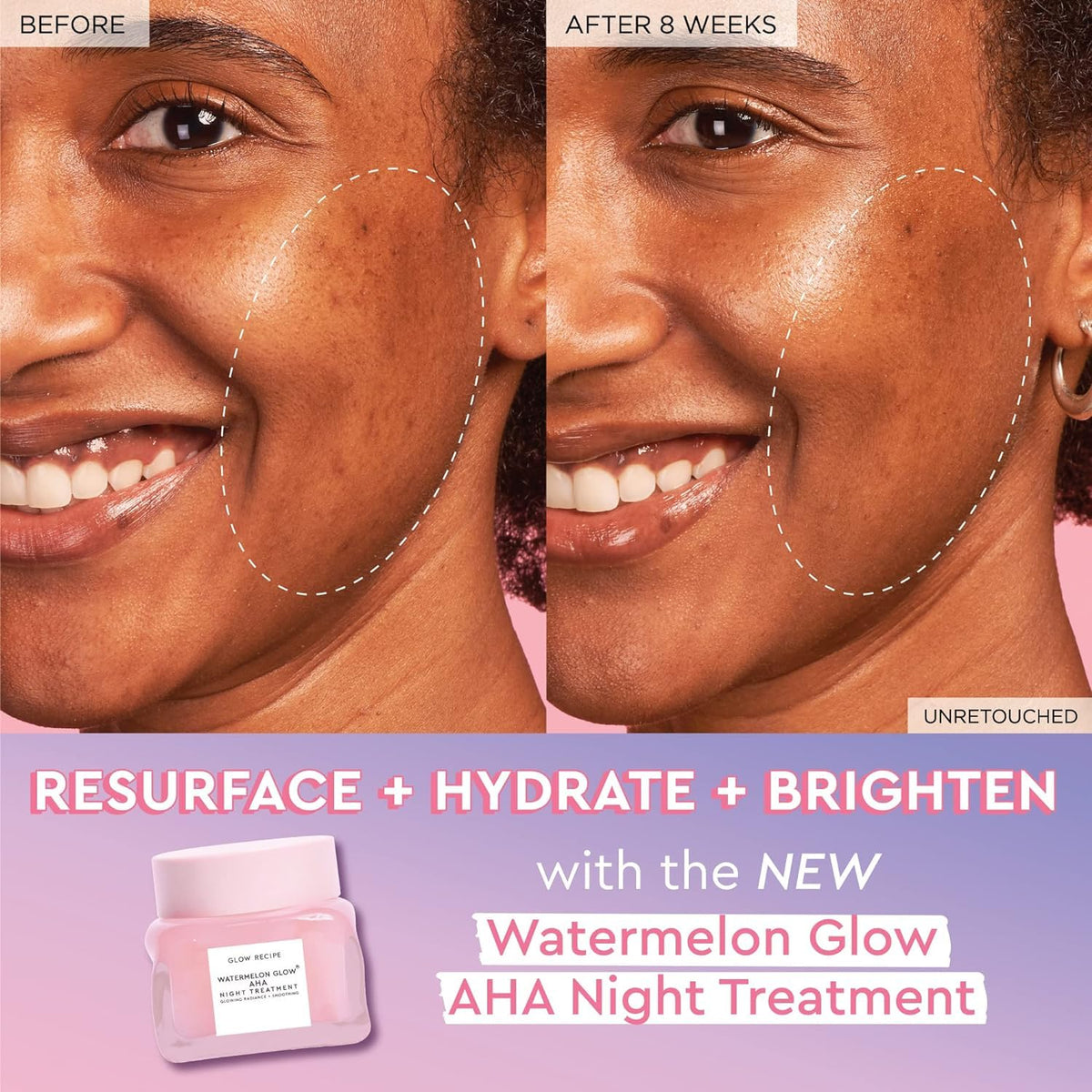 Watermelon PHA + BHA Facial Pore Toner (40 ml) + Niacinamide Dew Drops Brightening Serum (40 ml) + AHA Anti Aging Sleeping Mask (60 ml) X876304